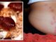 Doctor warns of four health risks linked to bed bugs amid threat of infestation in UK